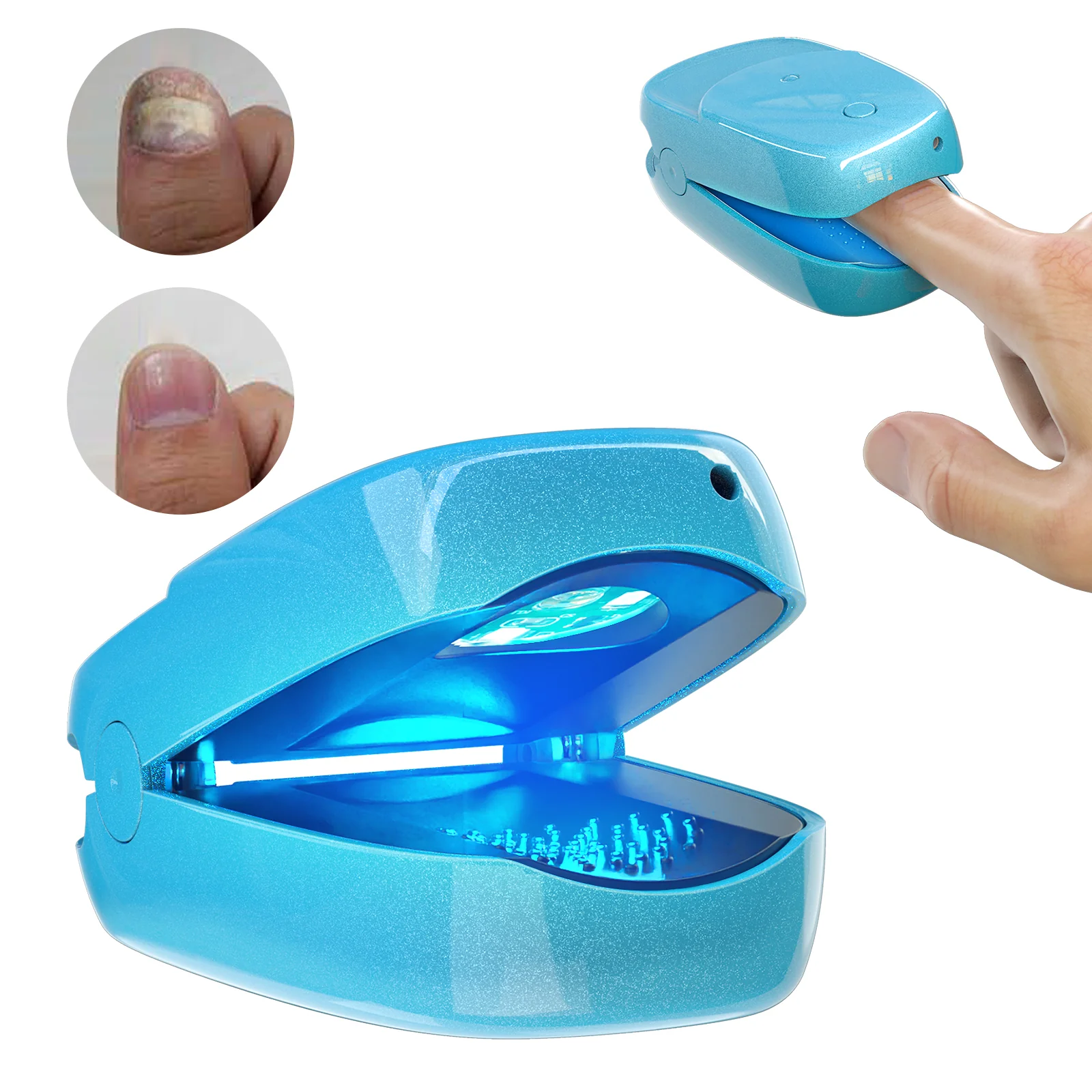 FDA Cleared Portable Laser Therapy Nail Cleaning Device - Image 3