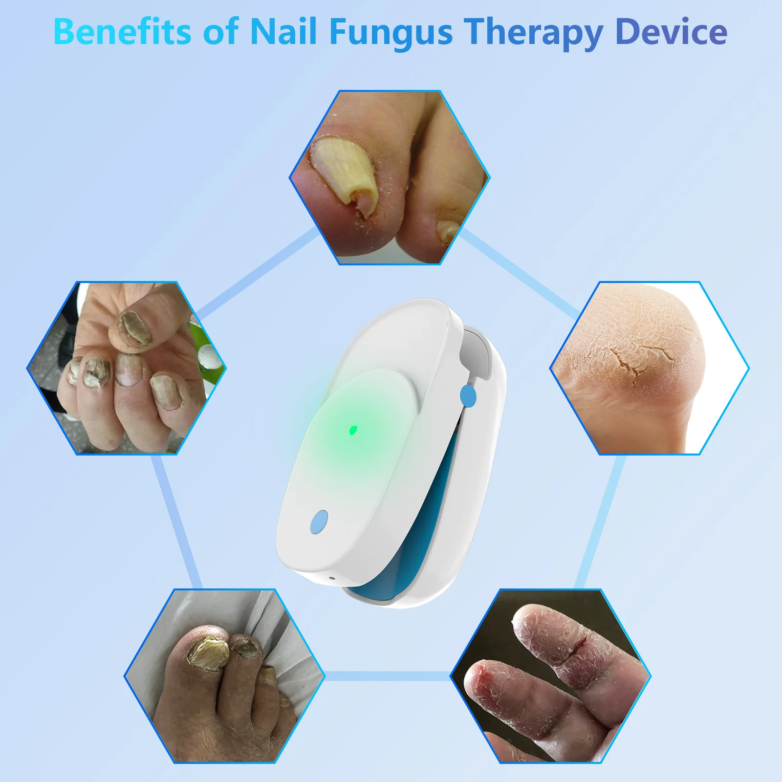 FDA Cleared Portable Laser Therapy Nail Cleaning Device - Image 3