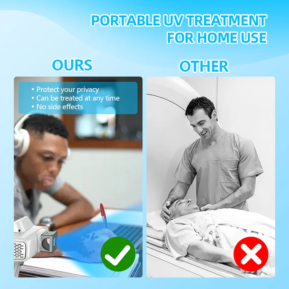 KTS 308nm UVB excimer light therapy apparatus - Image 5