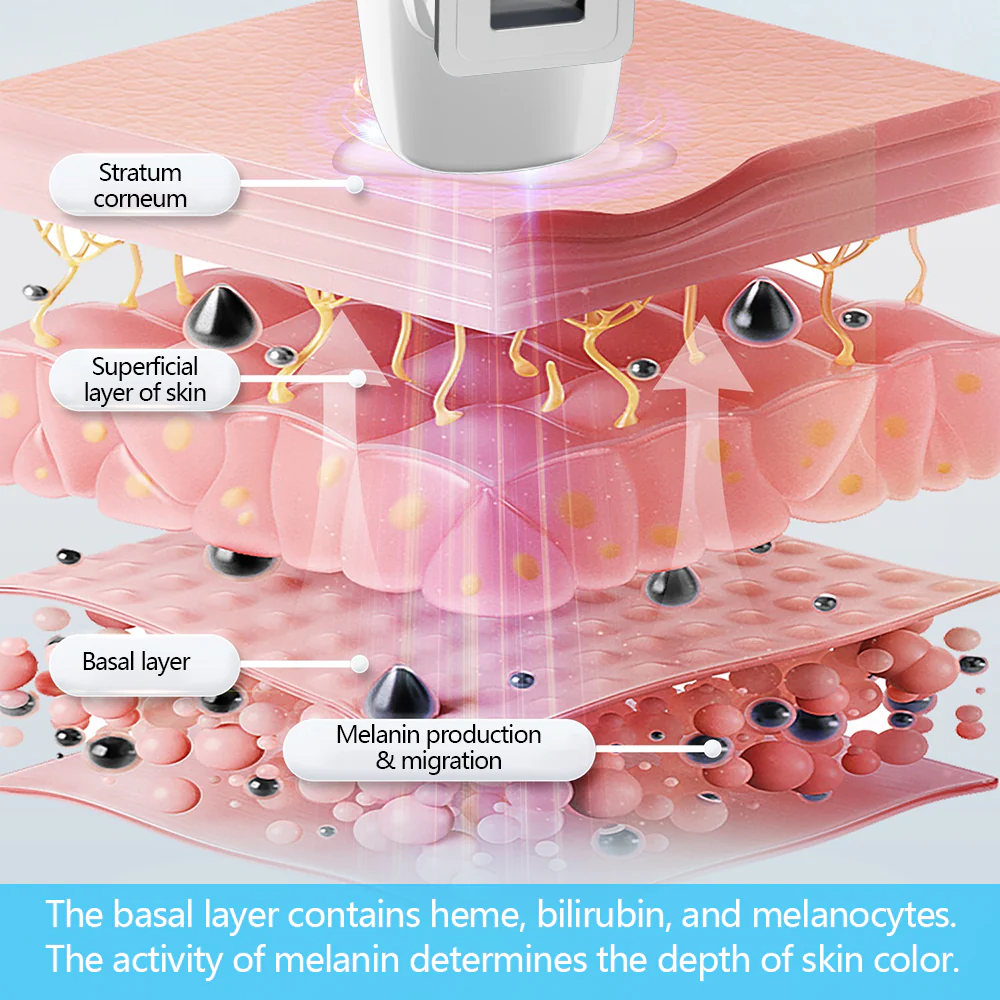 KTS 308nm UVB excimer light therapy apparatus - Image 6