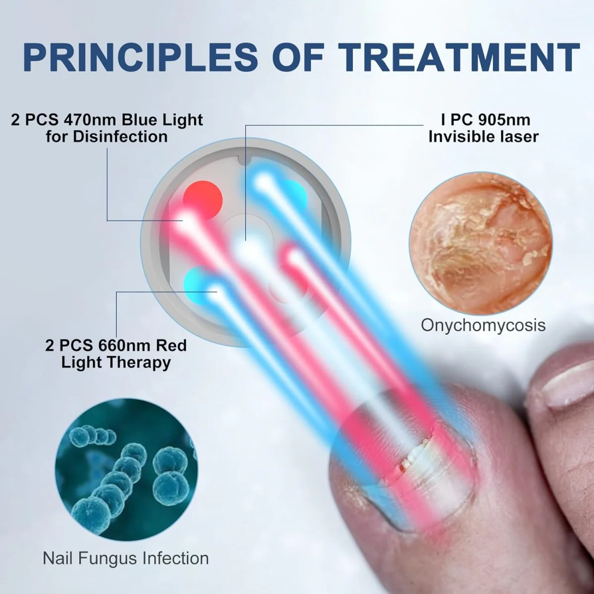 KTS Fungal Nail Treatment Device - Image 3