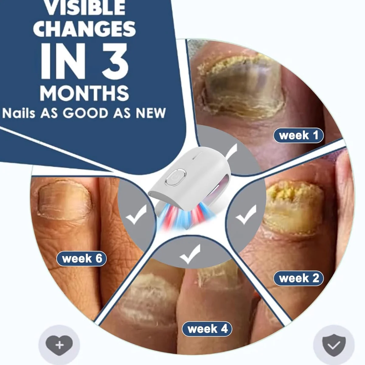 KTS Fungal Nail Treatment Device - Image 6