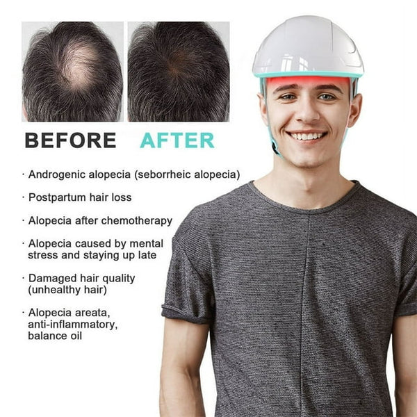 KTS® Hair Regrowth Treatments Laser Cap - Image 3