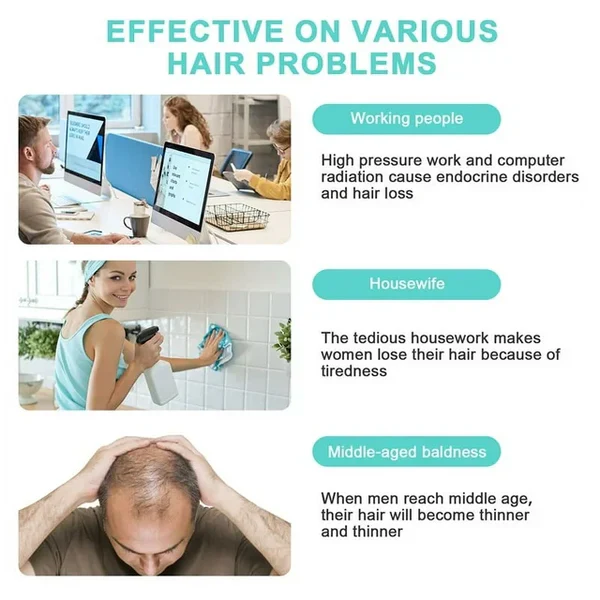 KTS® Hair Regrowth Treatments Laser Cap - Image 4