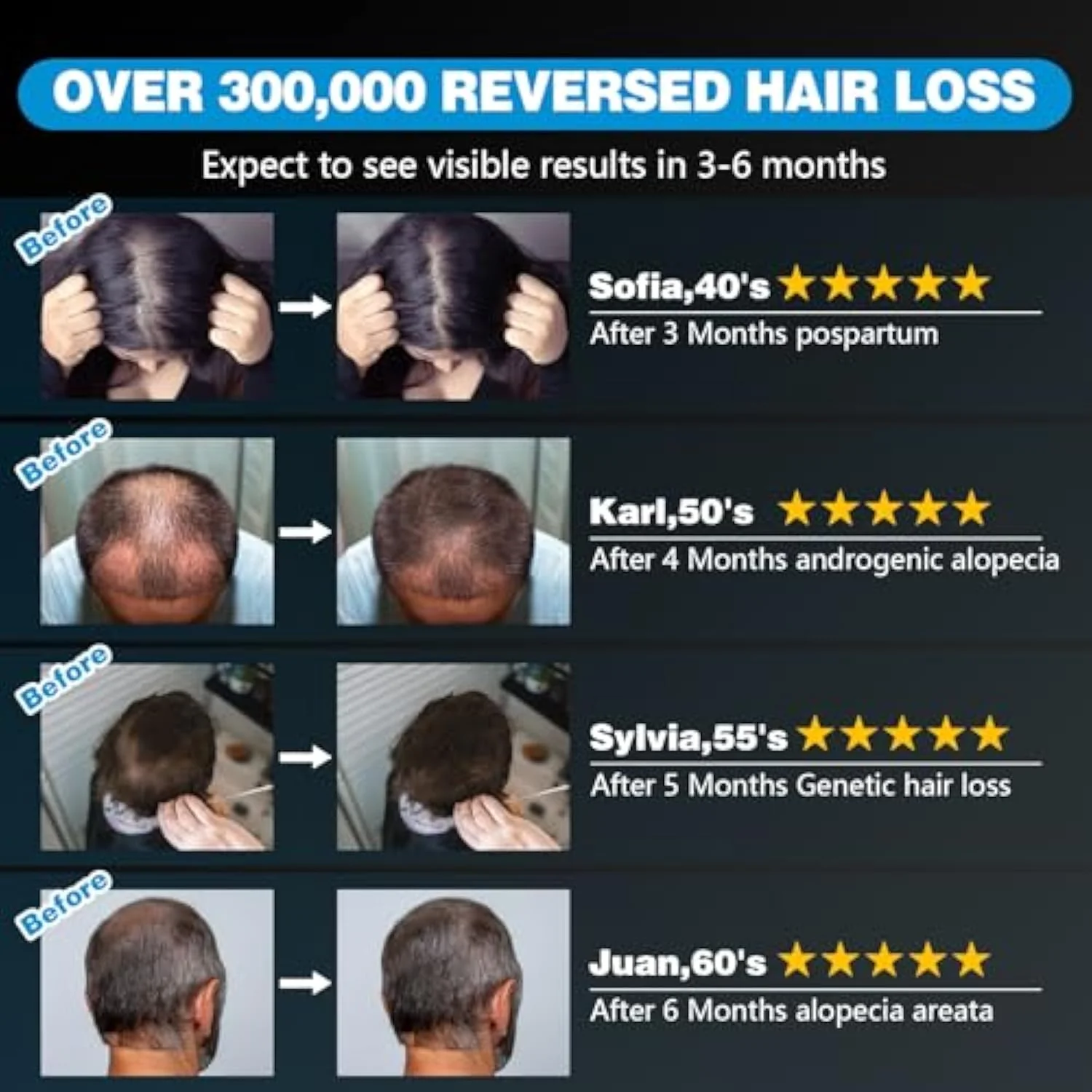 KTS® Laser Hair Regrowth Cap 1.0 Pro - Image 6