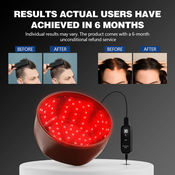 KTS® Laser Hair Regrowth Cap 1.0 Pro - Image 5
