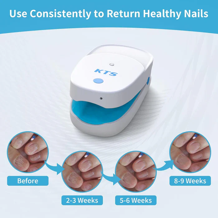 KTS® Nail Fungus Laser Treatment Device Collection - Image 10