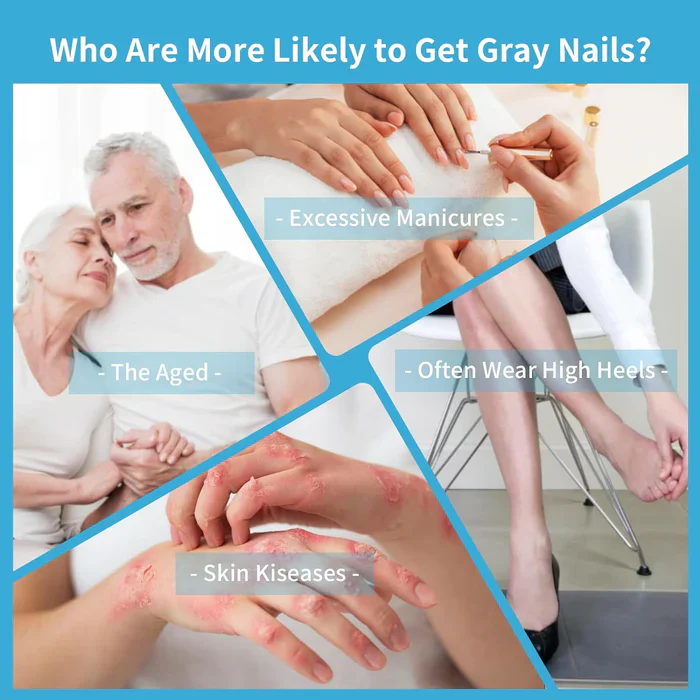 KTS® Nail Fungus Laser Treatment Device Collection - Image 12