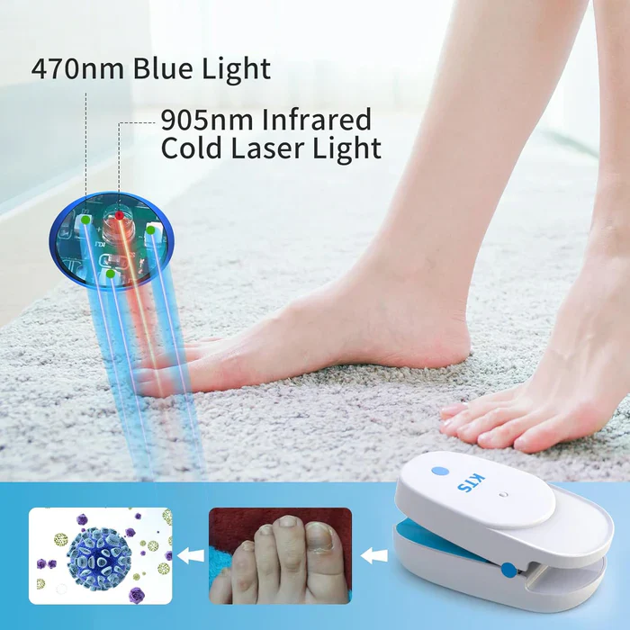 KTS® Nail Fungus Laser Treatment Device Collection - Image 14