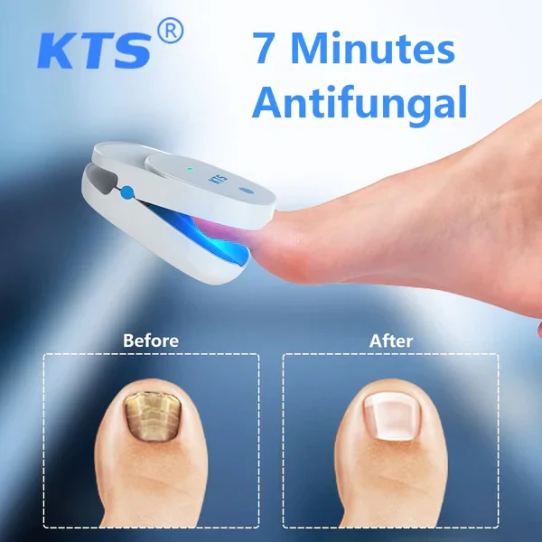 KTS® Nail Fungus Laser Treatment Device Collection - Image 9
