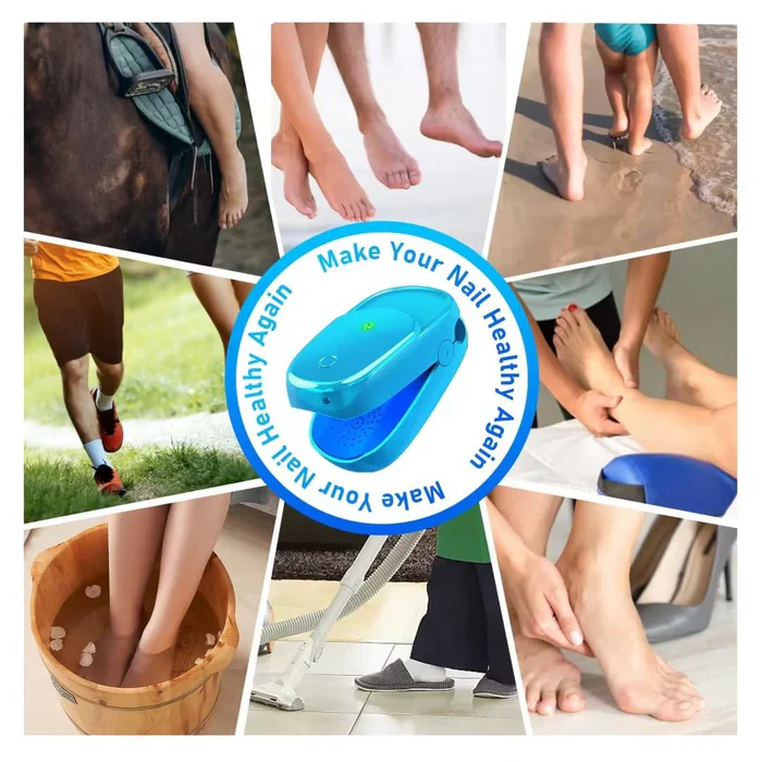 KTS® New Onychomycosis Laser Treatment Device - Image 7