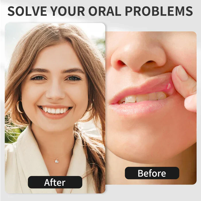 KTS® Red Light Oral Therapy Device - Image 4