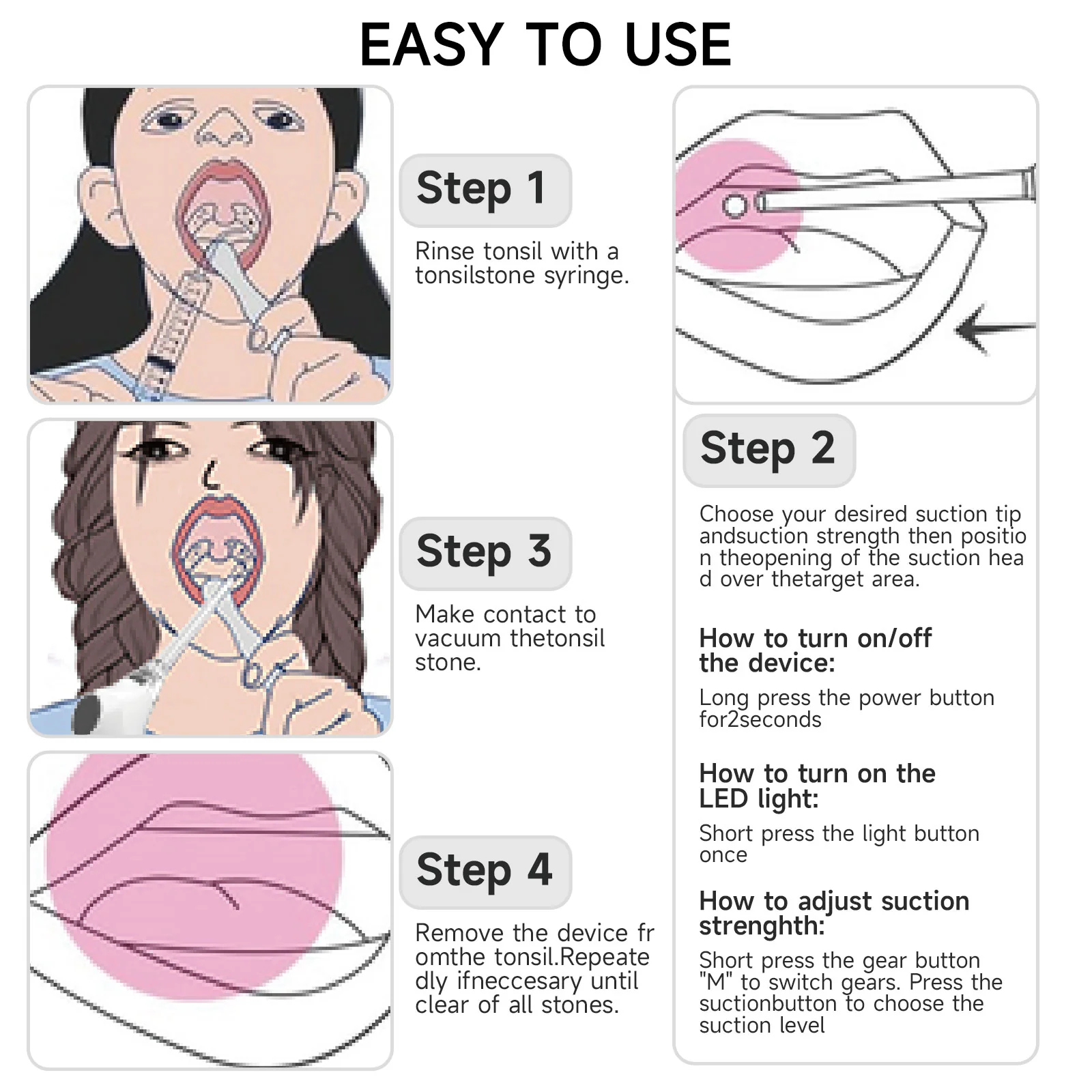 KTS Tonsil Stone Removal Kit with Irrigation Syringe - Image 6